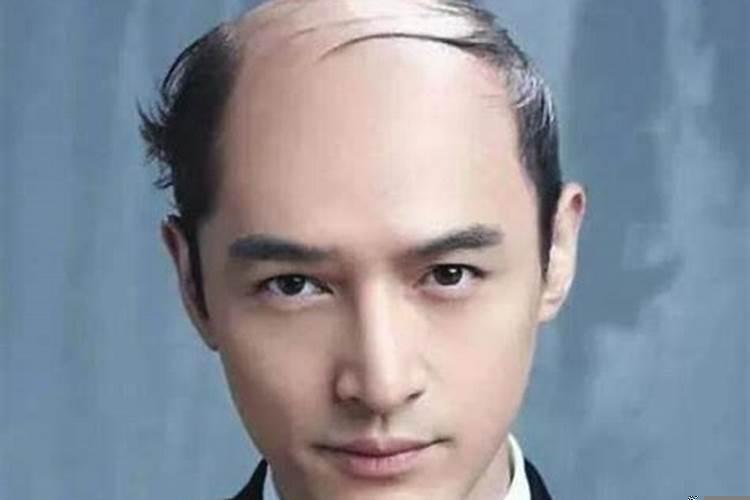 梦到自己头发秃了一块什么意思